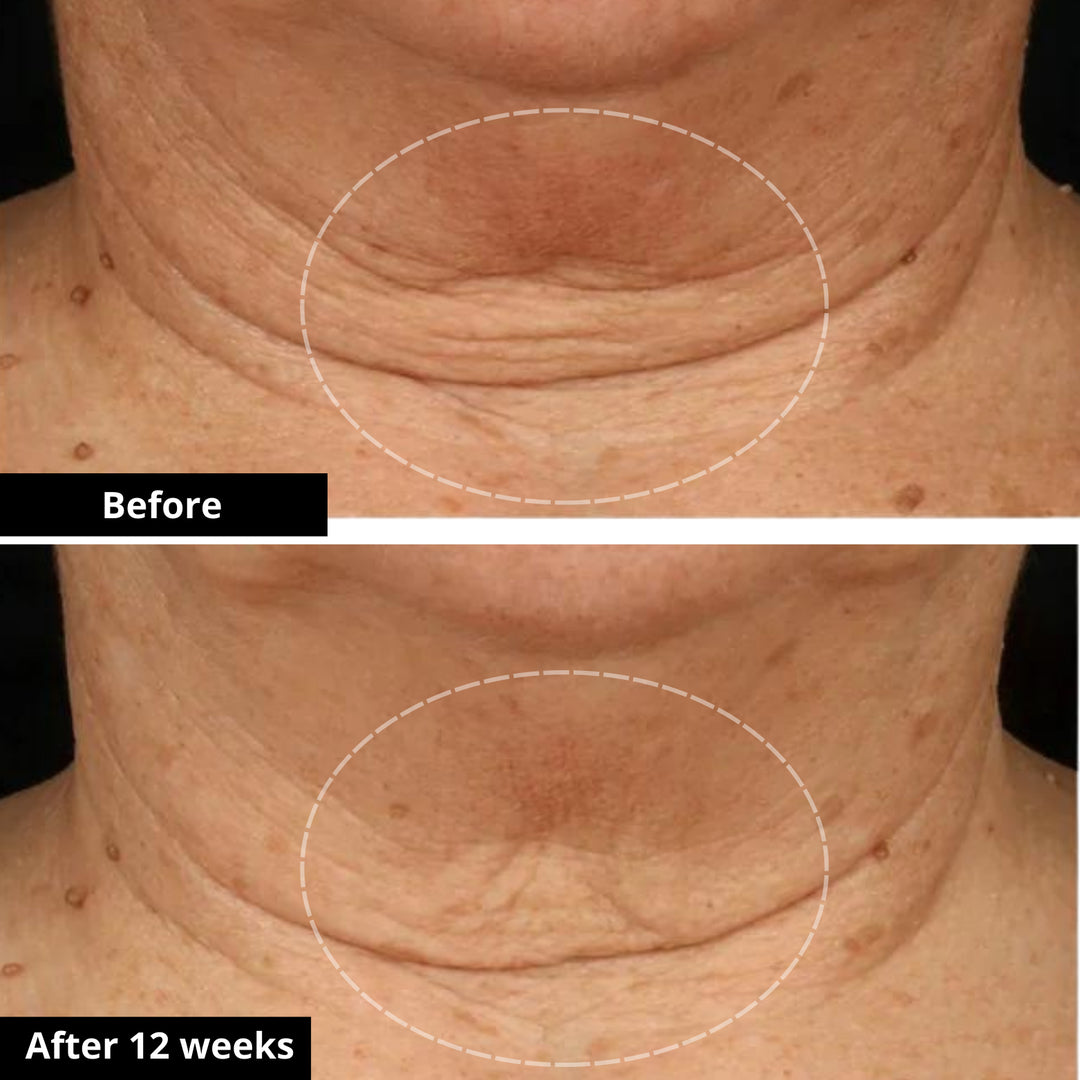 Tighten & Lift Neck Cream