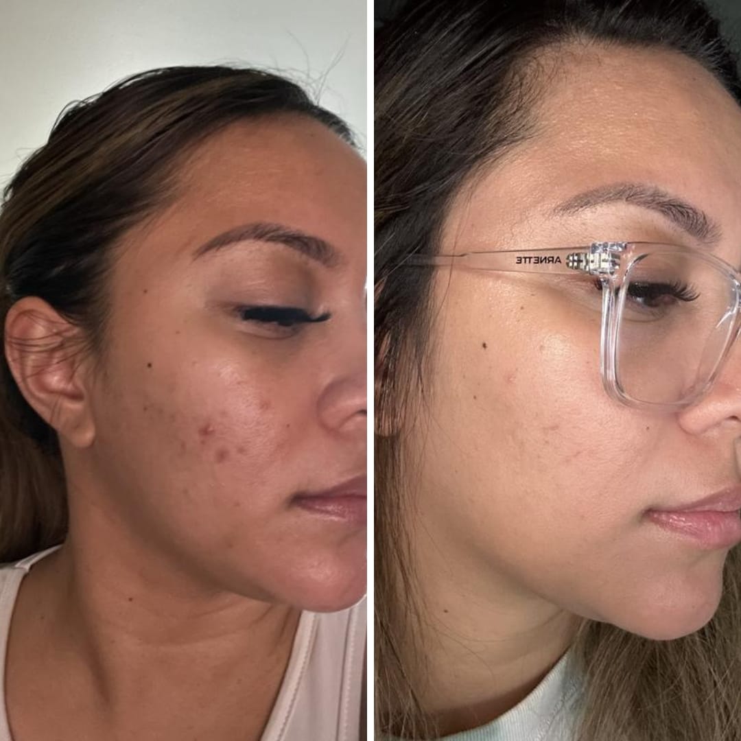 Turmeric Touch Cleanser - [30 Day Glow up]