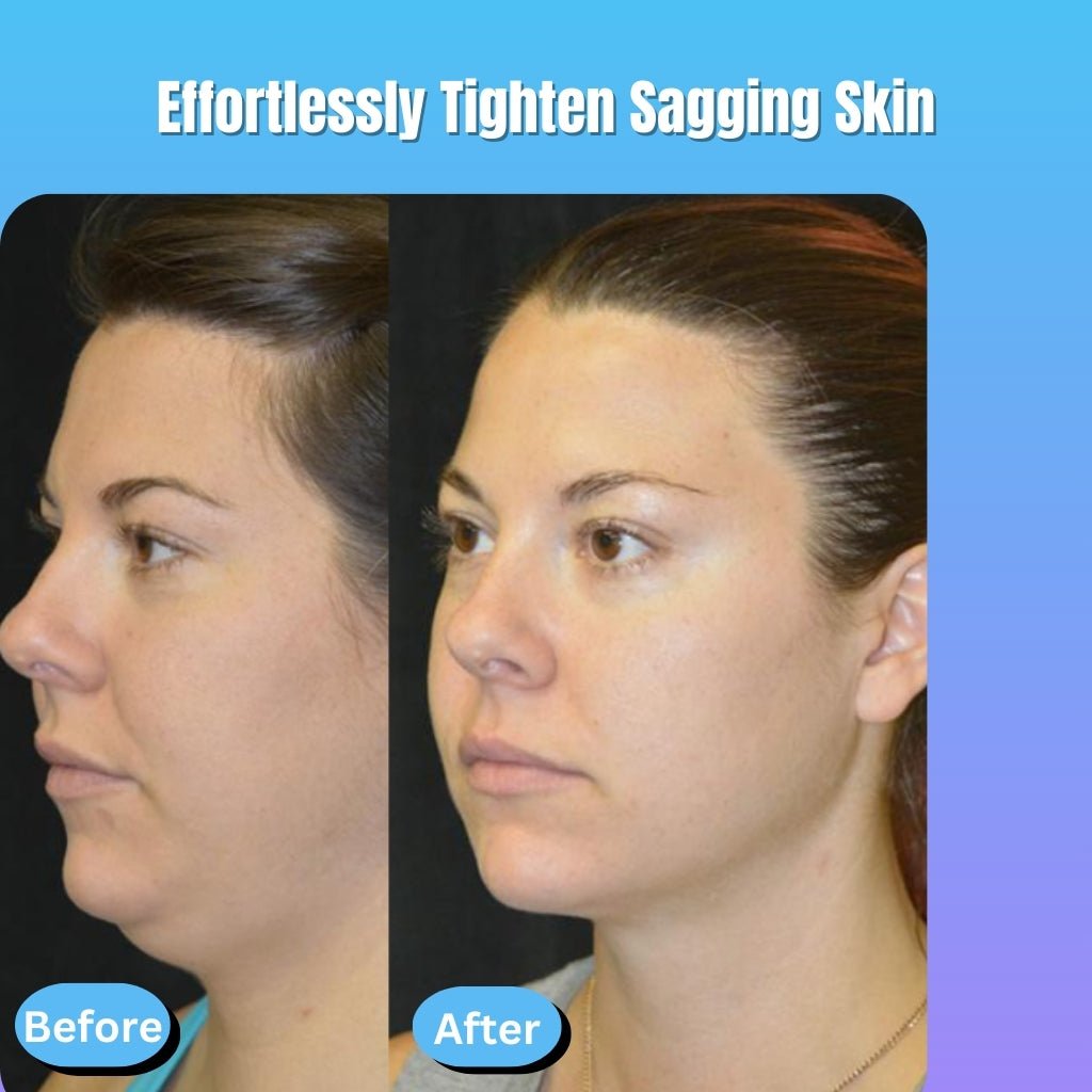 4-in-1 facial sculptor