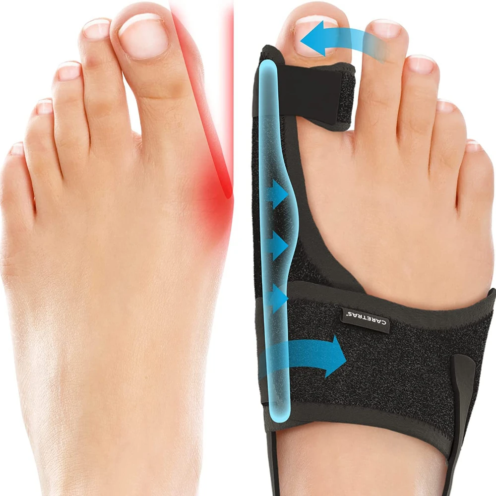 Bunion Brace