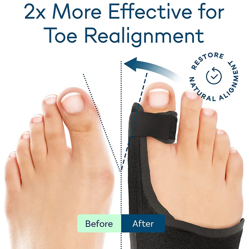 Bunion Brace