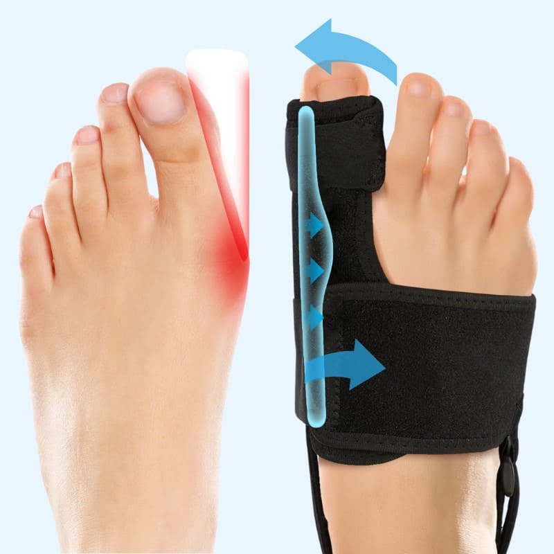 Bunion Brace