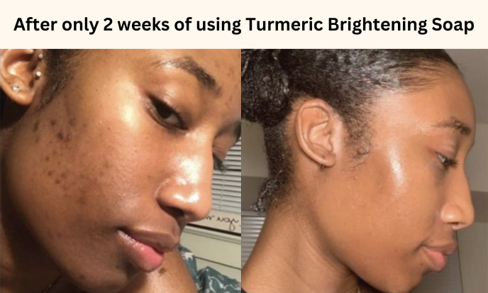 Turmeric Brightening Soap